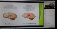 کنفرانس علمی یک روزه ارزیابی و مدیریت درمان صرع